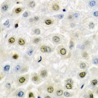 SSRP1 Rabbit Polyclonal Antibody