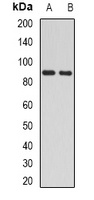 H6PD Rabbit Polyclonal Antibody