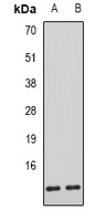 AHSP Rabbit Polyclonal Antibody
