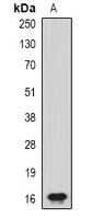 CHRAC17 Rabbit Polyclonal Antibody