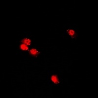CHRAC17 Rabbit Polyclonal Antibody