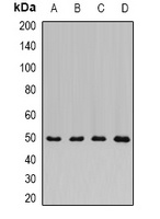 ADSS Rabbit Polyclonal Antibody