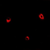 ADSS Rabbit Polyclonal Antibody