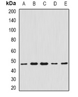 CCBL1 Rabbit Polyclonal Antibody