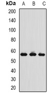 TCP1-delta Antibody