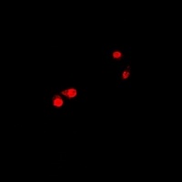 CTNNBL1 Antibody