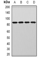 DDX1 Rabbit Polyclonal Antibody