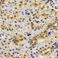 DDX1 Rabbit Polyclonal Antibody