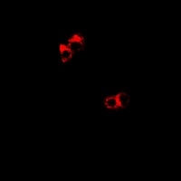 DDX1 Rabbit Polyclonal Antibody