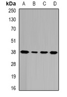 GALE Rabbit Polyclonal Antibody