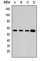 GLUD2 Rabbit Polyclonal Antibody