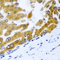 GPD2 Rabbit Polyclonal Antibody