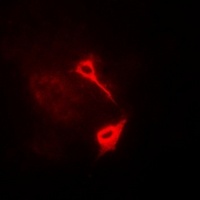 HAS3 Rabbit Polyclonal Antibody