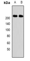 KIF1B Rabbit Polyclonal Antibody