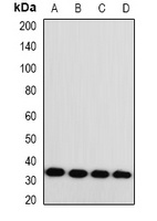 Monoglyceride Lipase Rabbit Polyclonal Antibody