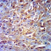 Monoglyceride Lipase Rabbit Polyclonal Antibody