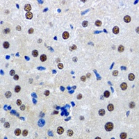 MTA3 Antibody