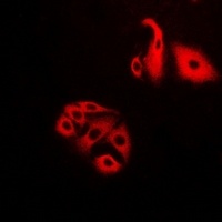 NFS1 Rabbit Polyclonal Antibody