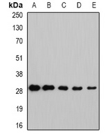 NNMT Rabbit Polyclonal Antibody