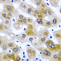 SBP-2 Rabbit Polyclonal Antibody