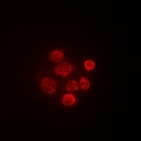 SBP-2 Rabbit Polyclonal Antibody