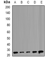 TMP21 Rabbit Polyclonal Antibody