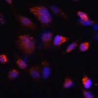 TMP21 Rabbit Polyclonal Antibody