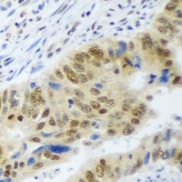 WDR48 Rabbit Polyclonal Antibody