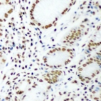 DR1 Rabbit Polyclonal Antibody