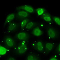 DR1 Rabbit Polyclonal Antibody