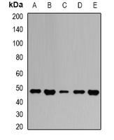 GOT2 Rabbit Polyclonal Antibody