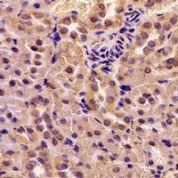 GOT2 Rabbit Polyclonal Antibody