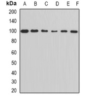 ALDH1L1 Rabbit Polyclonal Antibody