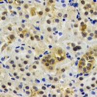 Rent2 Rabbit Polyclonal Antibody