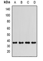 PTGES2 Rabbit Polyclonal Antibody
