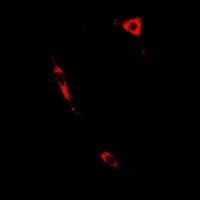 PTGES2 Rabbit Polyclonal Antibody