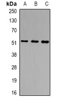 NSUN6 Rabbit Polyclonal Antibody