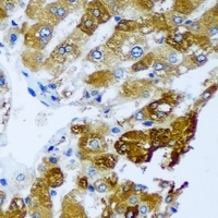 BLVRB Rabbit Polyclonal Antibody