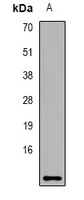 Dermcidin Rabbit Polyclonal Antibody