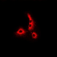 Dermcidin Rabbit Polyclonal Antibody