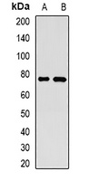 GP73 Rabbit Polyclonal Antibody