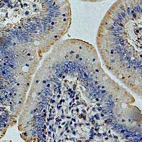 GP73 Rabbit Polyclonal Antibody