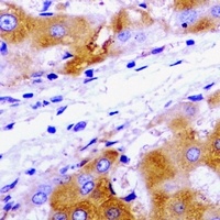 UBE2J2 Antibody