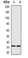 WBSCR22 Rabbit Polyclonal Antibody