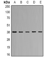 CapG Rabbit Polyclonal Antibody