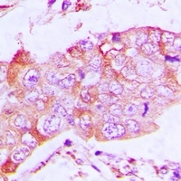CapG Rabbit Polyclonal Antibody