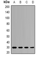 PSMB8 Rabbit Polyclonal Antibody