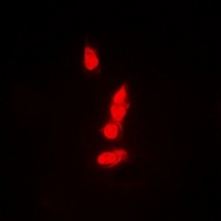 PSMB8 Rabbit Polyclonal Antibody