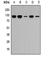 PRDM5 Rabbit Polyclonal Antibody