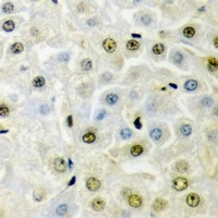 PRDM5 Rabbit Polyclonal Antibody